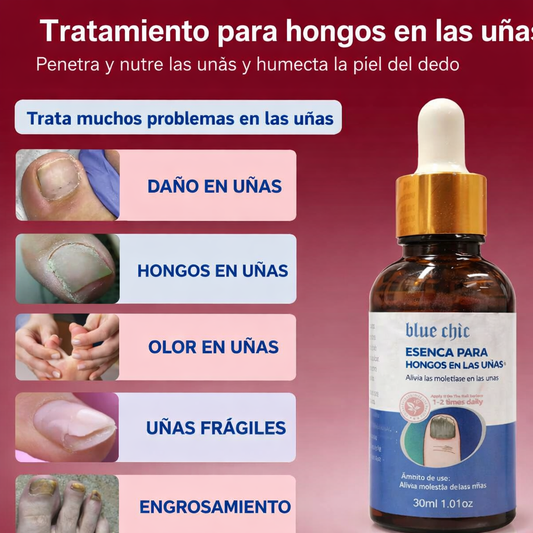 NAIL FUNGIS | ADIÓS AL HONGO